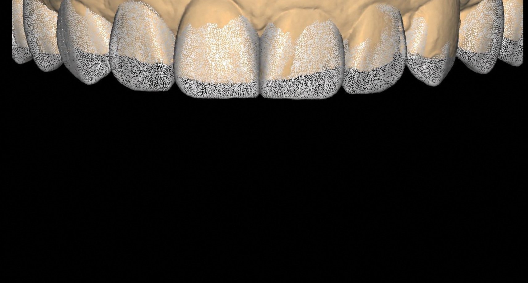 Diseño Digital de la Sonrisa en Carmay — planificación personalizada